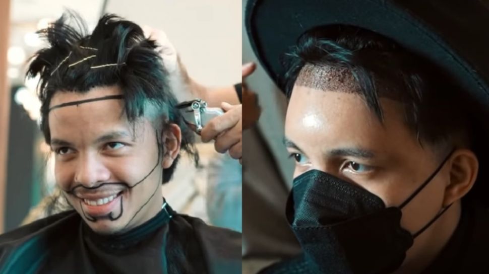implan rambut