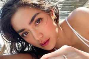 jessica iskandar operasi plastik