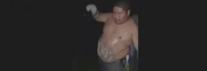 MALING OBESITAS