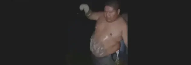 MALING OBESITAS