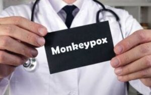 Cacar Monyet Monkeypox
