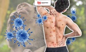 virus monkeypox, cacar monyet, vaksin cacar monyet, vaksin mpox