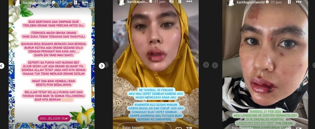 Kartika Putri