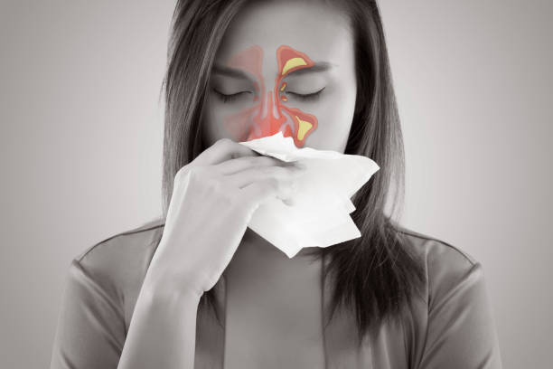 Terjadinya sinus