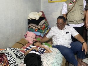 Daerah Lebakgede Mengidap Penyakit Hidrosefalus