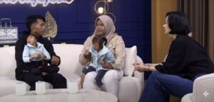 Kembar Seckel Syndrome